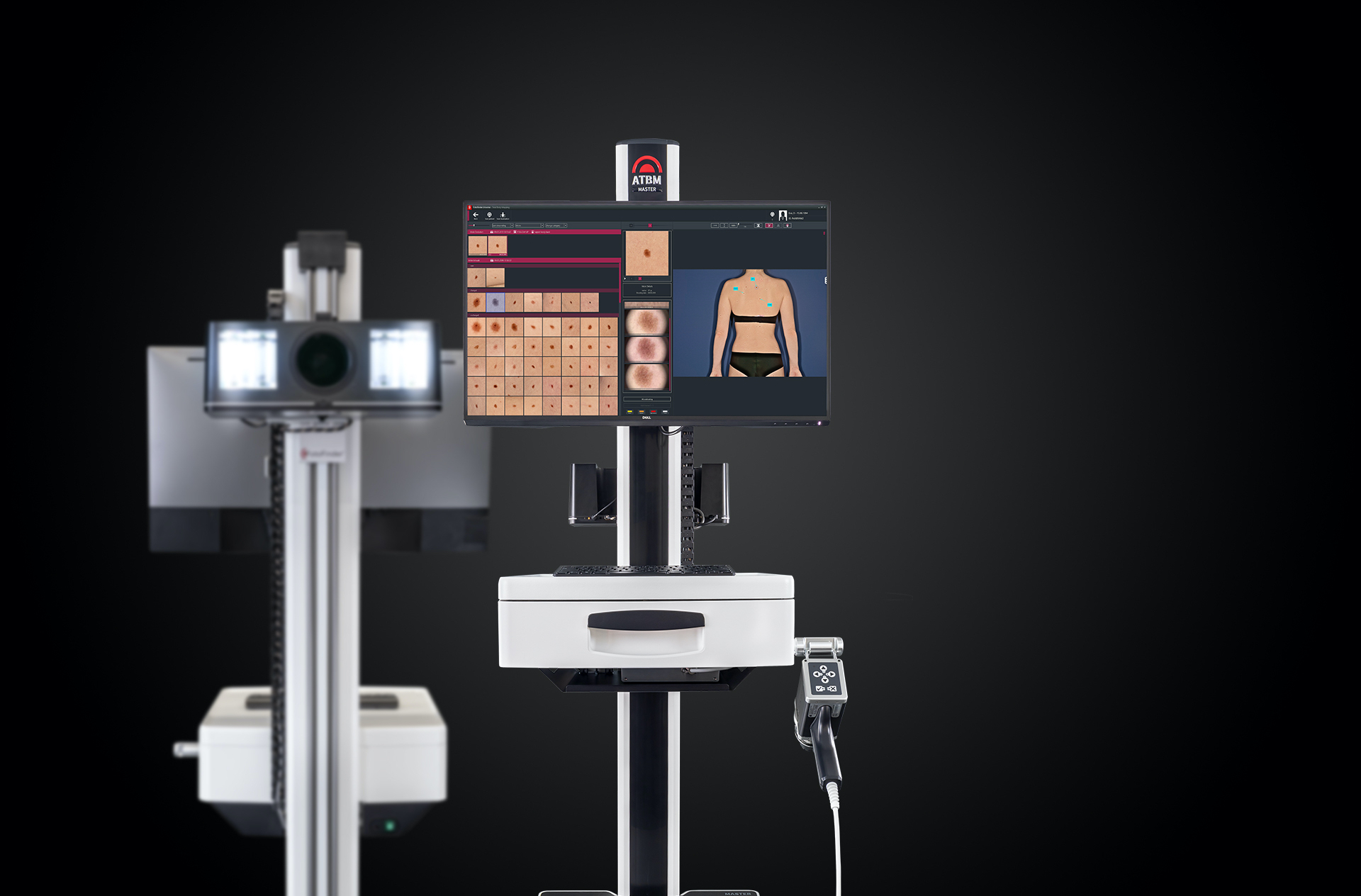 FotoFinder® full-body mole mapping at Thornhill Dermatology Centre